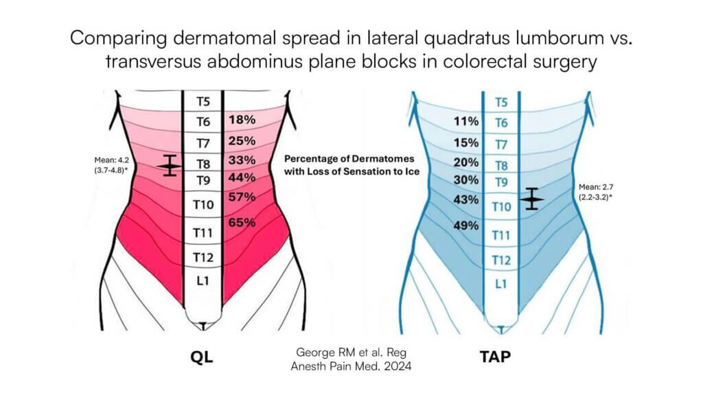 Comparing dermatomal spread in lateral quadratus lumborum vs. transversus abdominus plane blocks in colorectal surgery