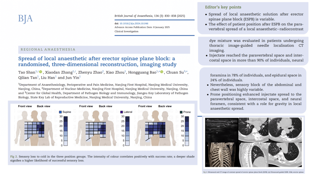 The effect of patient position on local anesthetic spread after erector spinae plane block