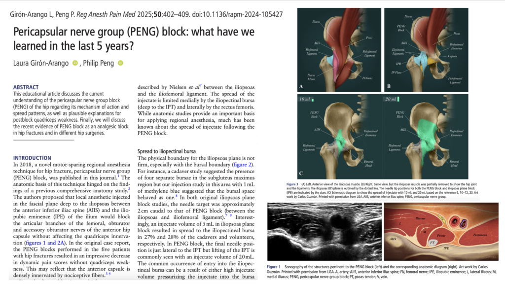 Pericapsular nerve group block: Five years of clinical evolution and insights