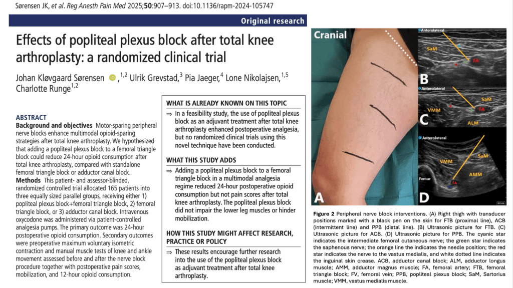 Popliteal plexus block + femoral triangle block after TKA: Modest opioid savings with preserved strength