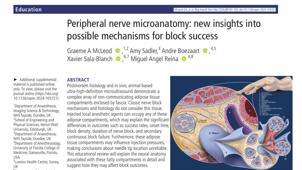 Fat, fascia, and failure: how perineural adipose tissue architecture redefines nerve block success