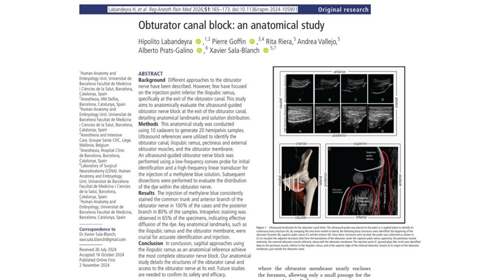 Ultrasound-guided obturator canal block: New anatomical insights for regional anesthesia practice