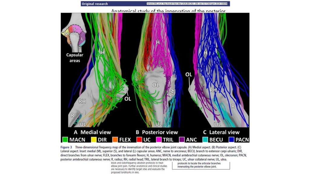 3D mapping of posterior elbow innervation: Implications for targeted pain interventions