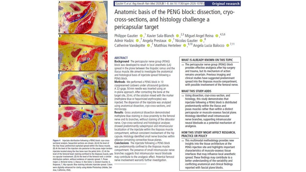 Is the PENG block really pericapsular? New anatomical evidence challenges its proposed mechanism