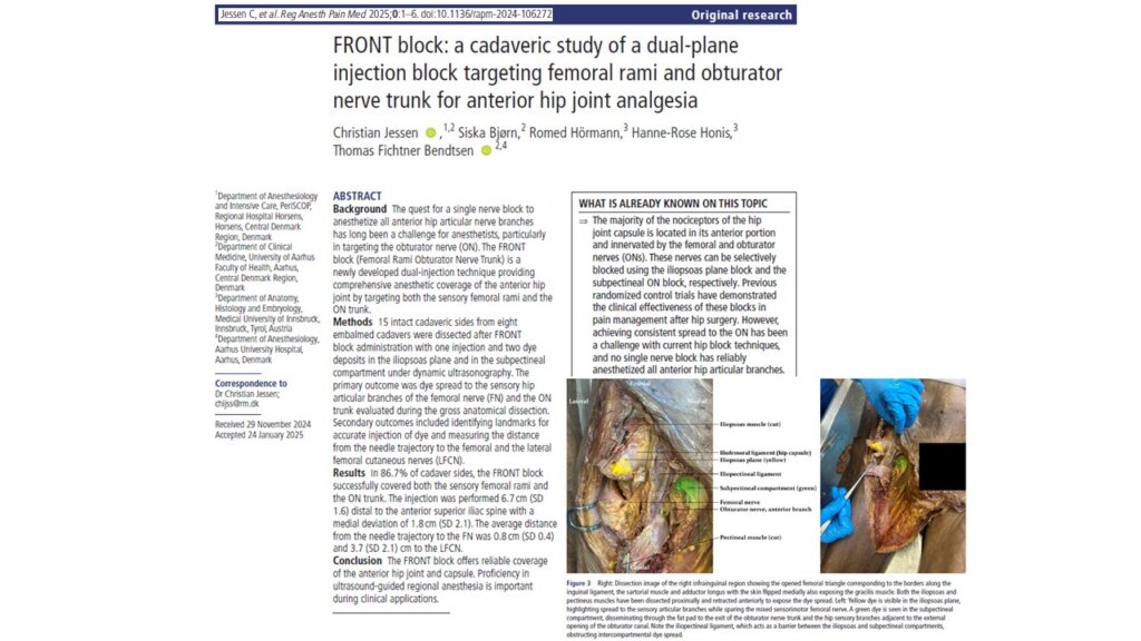 FRONT Block: A New dual-plane approach to anterior hip analgesia